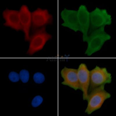 Phospho-MEKK1 (Thr1402) Antibody - AF3604 staining Hela cells(30min of UV treatment) by IF/ICC.