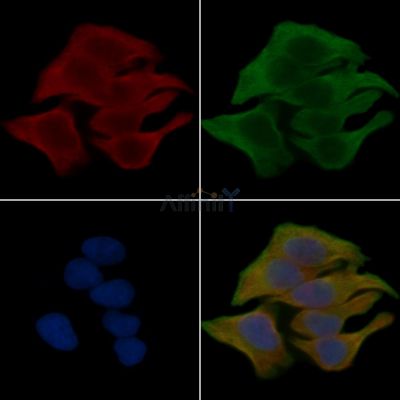 Phospho-AQP2 (Ser269) Antibody - AF3674 staining Hela cells(30min of UV treatment) by IF/ICC.