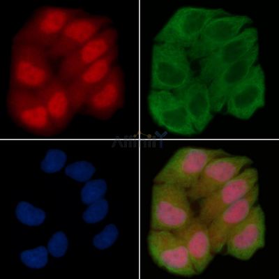 Phospho-c-Fos (Thr232) Antibody - AF3755 staining Hela cells(30min of UV treatment) by IF/ICC.