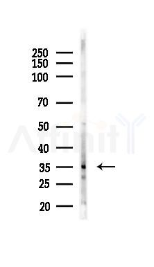 Phospho-MKK3/MKK6 (Ser189/Thr193) Antibody - Western blot analysis of lysates from COLO205 cells(heat-shock 45min treatment), using Phospho-MKK3/MKK6 (Ser189/Thr193) Antibody at 1/1000 dilution.