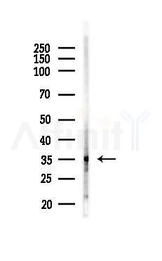 Phospho-MKK3/MKK6 (Ser189/Thr193) Antibody - Western blot analysis of lysates from PC12 cells(heat-shock 45min treatment), using Phospho-MKK3/MKK6 (Ser189/Thr193) Antibody at 1/1000 dilution.