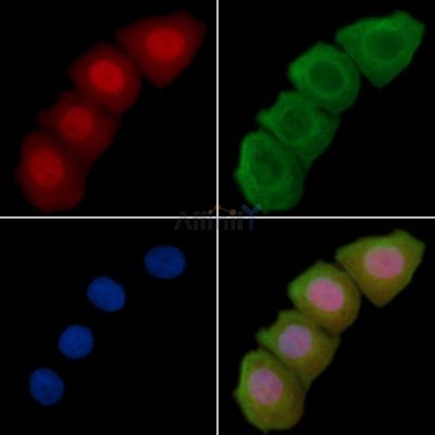 Phospho-ARRB1 (Ser412) Antibody - AF3806 staining Hela cells(30min of UV treatment) by IF/ICC.