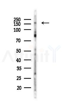Phospho-IRS1 (Tyr989) Antibody - Western blot analysis of lysates from COLO205 cells(heat-shock 45min treatment), using Phospho-IRS1 (Tyr989) Antibody at 1/1000 dilution.