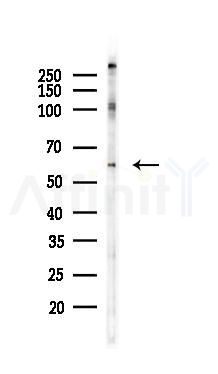 Phospho-p57 Kip2 (Thr310) Antibody - Western blot analysis of lysates from COLO205 cells(heat-shock 45min treatment), using Phospho-p57 Kip2 (Thr310) Antibody at 1/1000 dilution.