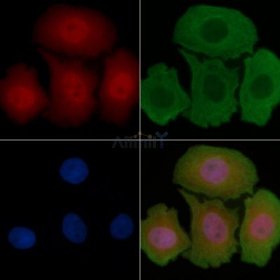 Phospho-EZH2 (Ser21) Antibody - AF3822 staining Hela cells(30min of UV treatment) by IF/ICC.