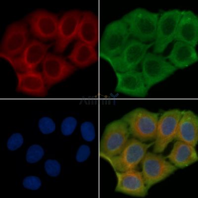 Phospho-TGFBR1 (Thr186) Antibody - AF3854 staining Hela cells(30min of UV treatment) by IF/ICC.