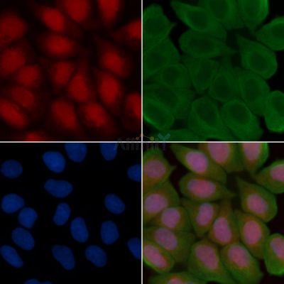 Phospho-n-Myc (Ser261/Ser263) Antibody - AF3881 staining Hela cells(30min of UV treatment) by IF/ICC.