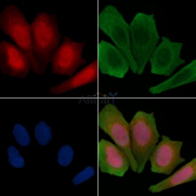 Phospho-Parkin (Ser378) Antibody - AF3889 staining Hela cells(30min of UV treatment) by IF/ICC.