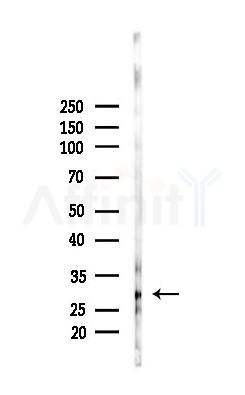 Phospho-ROCK1 (Thr455/Ser456) Antibody - Western blot analysis of lysates from Rat testis, using Phospho-ROCK1 (Thr455/Ser456) Antibody at 1/1000 dilution.