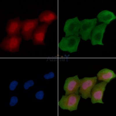 Phospho-Cdc27 (Thr244) Antibody - AF3897 staining Hela cells(30min of UV treatment) by IF/ICC.