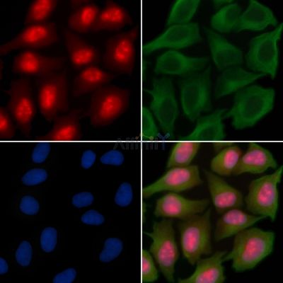 Phospho-RIP3 (Thr231/Ser232) Antibody - AF3900 staining Hela cells(30min of UV treatment) by IF/ICC.