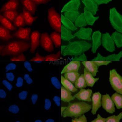 Phospho-MLKL (Ser360) Antibody - AF3901 staining Hela cells(30min of UV treatment) by IF/ICC.