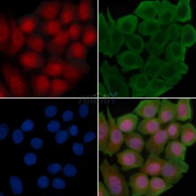 Phospho-CAD (Thr456) Antibody - AF3916 staining Hela cells(30min of UV treatment) by IF/ICC.