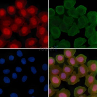 Phospho-UBF1 (Ser484) Antibody - AF3925 staining Hela cells(30min of UV treatment) by IF/ICC.