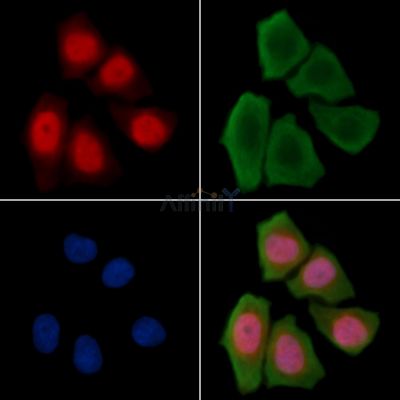 Phospho-C/EBP epsilon (Thr74) Antibody - AF3951 staining Hela cells(30min of UV treatment) by IF/ICC.