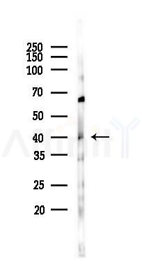 Phospho-p38 MAPK (Thr180/Tyr182) Antibody - Western blot analysis of lysates from HUVEC cells(starvation 24h treatment), using Phospho-p38 MAPK (Thr180/Tyr182) Antibody at 1/1000 dilution.