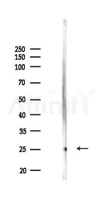 Cleaved-IL-1 beta (Asp116) Antibody - Western blot analysis of lysates from COLO205 cells(UV 30min treatment), using Cleaved-IL-1 beta (Asp116) Antibody at 1/1000 dilution.