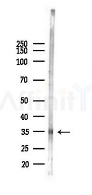 Rex1 Antibody - Western blot analysis of lysates from PC12 cells(heat-shock 45min treatment), using Rex1 Antibody at 1/1000 dilution.
