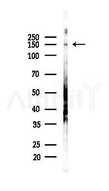 Phospho-ROCK1 (Tyr913) Antibody - Western blot analysis of lysates from PC12 cells(heat-shock 45min treatment), using Phospho-ROCK1 (Tyr913) Antibody at 1/1000 dilution.