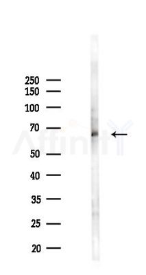 Phospho-STK3 (Ser316) Antibody - Western blot analysis of lysates from COLO205 cells(LPS 4h treatment), using Phospho-STK3 (Ser316) Antibody at 1/1000 dilution.