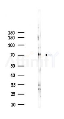 Phospho-STK3 (Ser316) Antibody - Western blot analysis of lysates from K562 cells(starvation 24h treatment), using Phospho-STK3 (Ser316) Antibody at 1/1000 dilution.
