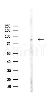 Phospho-P2X7 (Ser390) Antibody - Western blot analysis of lysates from COLO205 cells(LPS 4h treatment), using Phospho-P2X7 (Ser390) Antibody at 1/1000 dilution.
