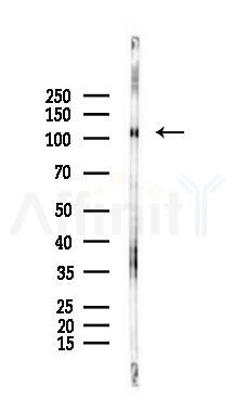 Phospho-PCAF (Tyr729) Antibody - Western blot analysis of lysates from HUVEC cells(starvation 24h treatment), using Phospho-PCAF (Tyr729) Antibody at 1/1000 dilution.
