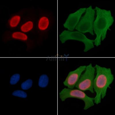 Acetyl-Histone H2A (Lys5) Antibody - AF4354 staining Hela cells(30min of UV treatment) by IF/ICC.