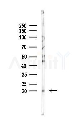 Acetyl-H2A.Z (Lys4/7/11/13) Antibody - Western blot analysis of lysates from Rat brain, using Acetyl-H2A.