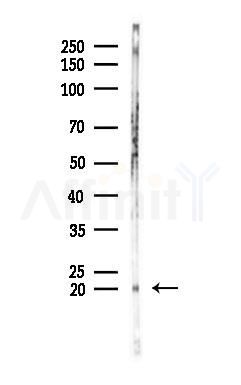 Acetyl-H2A.Z (Lys4/7/11/13) Antibody - Western blot analysis of lysates from B16F10-LUC cells(UV 30min treatment), using Acetyl-H2A.