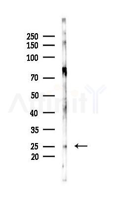 Acetyl-H2A.Z (Lys4/7/11/13) Antibody - Western blot analysis of lysates from Mouse lung, using Acetyl-H2A.