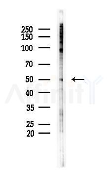 Phospho-Cyclin E1 (Ser73) Antibody - Western blot analysis of lysates from PC12 cells(starvation 24h treatment), using Phospho-Cyclin E1 (Ser73) Antibody at 1/1000 dilution.