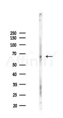 Phospho-OPRM1 (Ser375)[Ser377] Antibody - Western blot analysis of lysates from COLO205 cells(LPS 4h treatment), using Phospho-OPRM1 (Ser375)[Ser377] Antibody at 1/1000 dilution.