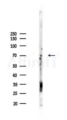 Phospho-OPRM1 (Ser375)[Ser377] Antibody - Western blot analysis of lysates from K562 cells(starvation 24h treatment), using Phospho-OPRM1 (Ser375)[Ser377] Antibody at 1/1000 dilution.