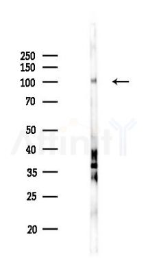 Phospho-GluR1 (Ser849) Antibody - Western blot analysis of lysates from Rat testis, using Phospho-GluR1 (Ser849) Antibody at 1/1000 dilution.