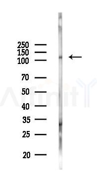 Phospho-p130 Cas (Tyr165) Antibody - Western blot analysis of lysates from Hela cells(LPS 4h treatment), using Phospho-p130 Cas (Tyr165) Antibody at 1/1000 dilution.