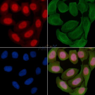 Phospho-PTEN (Ser380+Thr382+Thr383) Antibody - AF4450 staining Hela cells(30min of UV treatment) by IF/ICC.