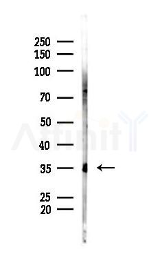 Phospho-MCL1 (Ser64) Antibody - Western blot analysis of lysates from B16F10-LUC cells(UV 30min treatment), using Phospho-MCL1 (Ser64) Antibody at 1/1000 dilution.