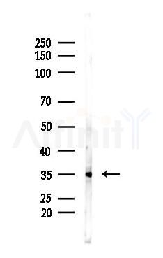 Phospho-MCL1 (Ser64) Antibody - Western blot analysis of lysates from Mouse lung, using Phospho-MCL1 (Ser64) Antibody at 1/1000 dilution.