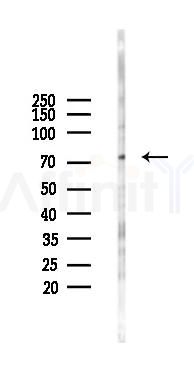 Phospho-GIT2 (Tyr592) Antibody - Western blot analysis of lysates from COLO205 cells(LPS 4h treatment), using Phospho-GIT2 (Tyr592) Antibody at 1/1000 dilution.