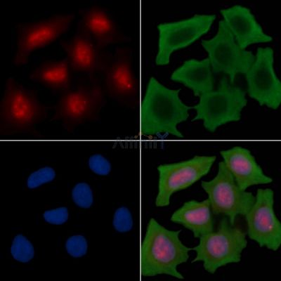 SIN3A Antibody - AF4612 staining Hela cells(30min of UV treatment) by IF/ICC.