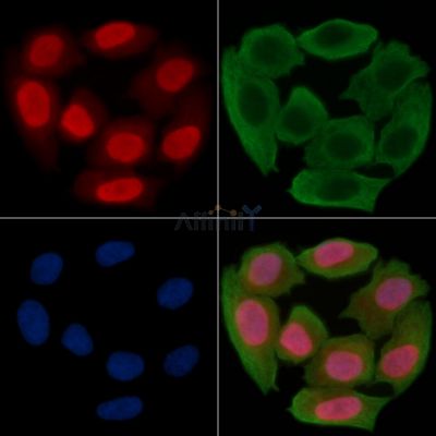 p53 Antibody - AF4663 staining Hela cells(30min of UV treatment) by IF/ICC.
