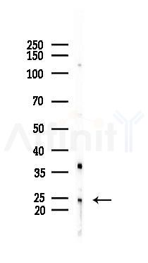 MOB1A Antibody - Western blot analysis of lysates from B16F10-LUC cells(UV 30min treatment), using MOB1A Antibody at 1/1000 dilution.