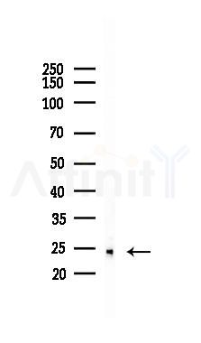 MOB1A Antibody - Western blot analysis of lysates from 293 cells(UV 30min treatment), using MOB1A Antibody at 1/1000 dilution.