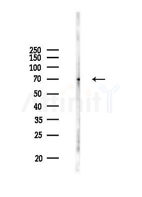 NF-kB p65 Antibody - Western blot analysis of lysates from B16F10-LUC cells(LPS 4h treatment), using NF-kB p65 Antibody at 1/1000 dilution.