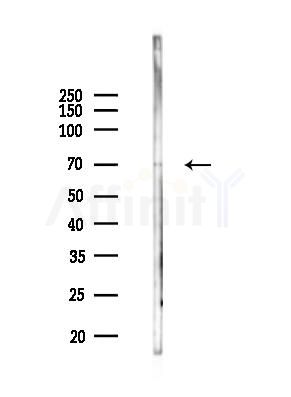 NF-kB p65 Antibody - Western blot analysis of lysates from HUVEC cells(starvation 24h treatment), using NF-kB p65 Antibody at 1/1000 dilution.