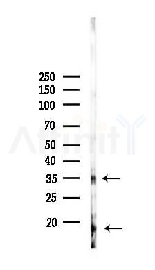 IL1 beta Antibody - Western blot analysis of lysates from HepG2 cells(heat-shock 45min treatment), using IL1 beta Antibody at 1/1000 dilution.