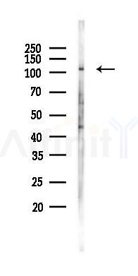 PI3 kinase P110 alpha Antibody - Western blot analysis of lysates from 293 cells(heat-shock 45min treatment), using PI3 kinase P110 alpha Antibody at 1/1000 dilution.