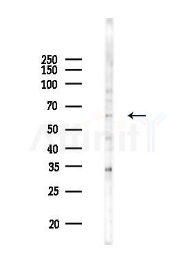 FAST kinase Antibody - Western blot analysis of lysates from 293 cells(heat-shock 45min treatment), using FAST kinase Antibody at 1/1000 dilution.