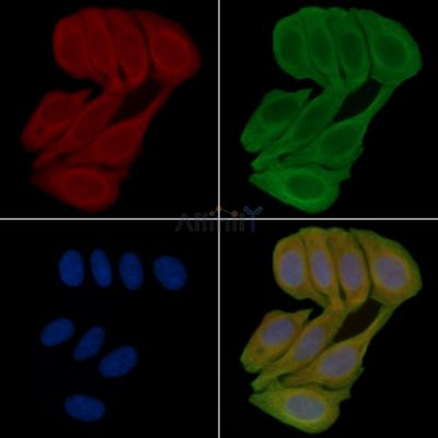 Vinculin Antibody - AF5122 staining Hela cells(30min of UV treatment) by IF/ICC.
